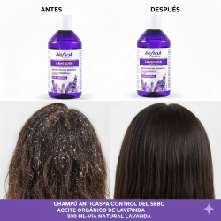 Champú anticaspa control del sebo ACEITE ORGÁNICO DE LAVANDA 300 ml-VIA NATURAL LAVANDA